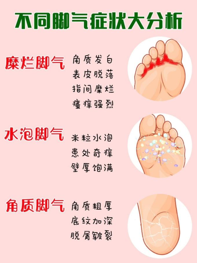 专注脚气健康的一家店铺