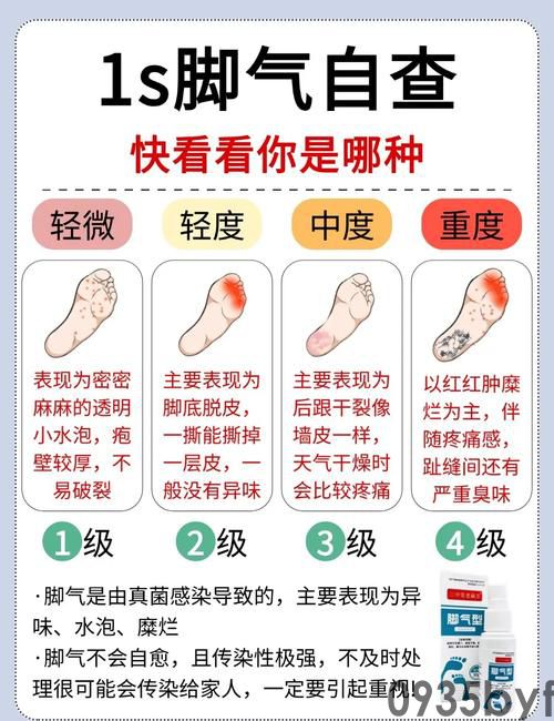 全球脚气发病率持续攀升:最新研究揭示现代生活方式带来的健康隐患(图5) u=3734966836,2319845531&fm=253&app=138&f=JPEG.jpg