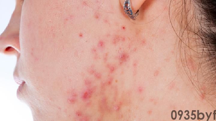 什么是皮肤瘙痒症？