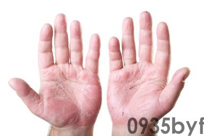 脚气病是不是足藓(图1) 脚气病是不是足藓