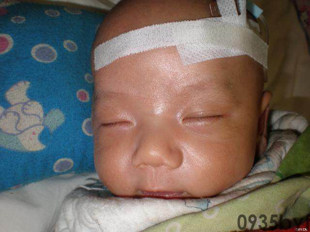 常见皮肤疾病典型图片汇总(图5)