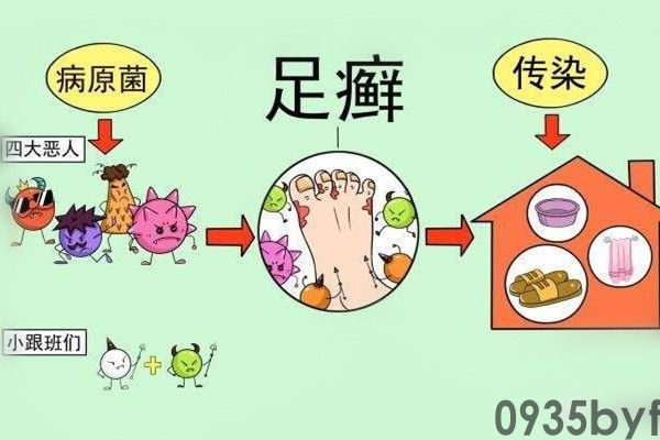 脚脱皮是脚气吗(图1) 脚脱皮是脚气吗