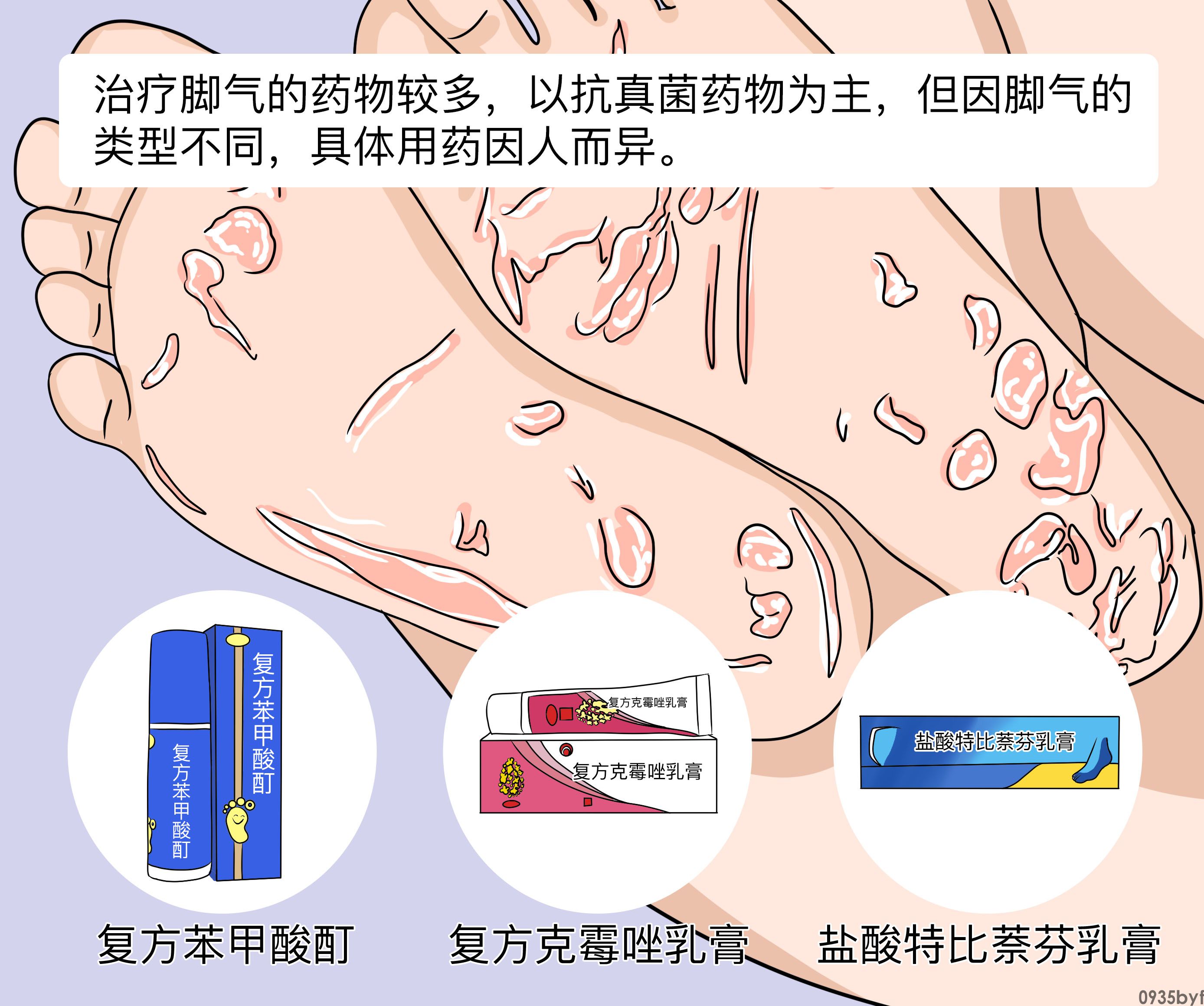 治疗脚气的药有哪些-有来医生(图1)