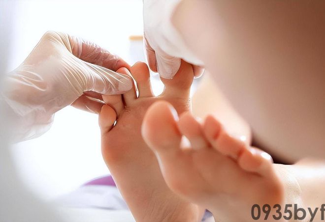 我国脚气患者上亿人这些东西才脚气的“祸根”!(图1) 我国脚气患者上亿人这些东西才脚气的“祸根”!(图1)