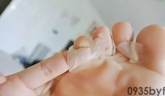 我国脚气患者上亿人这些东西才脚气的“祸根”!(图7) 我国脚气患者上亿人这些东西才脚气的“祸根”!(图7)