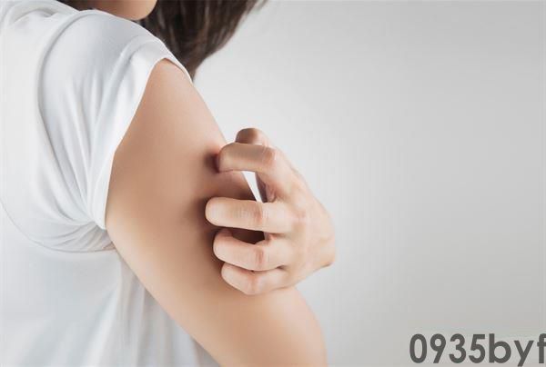 异位性皮炎的症状是什么(图1) 异位性皮炎的症状是什么