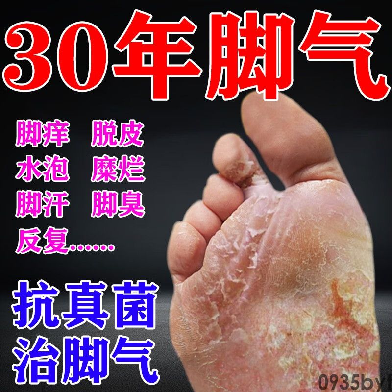 脚气为什么会脱皮