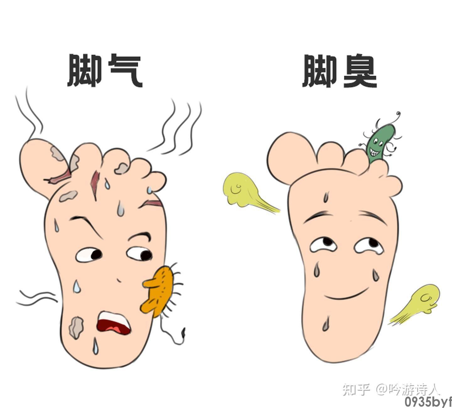 脚臭的治疗方式有哪些