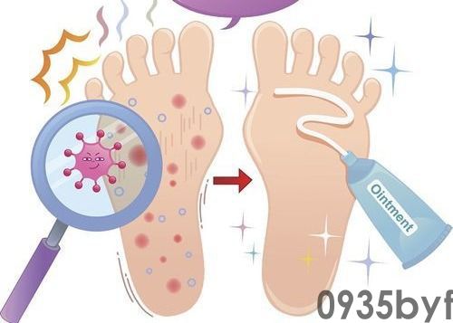 水泡型脚气能自愈吗-有来医生