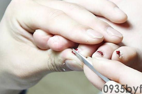 脚气会不会传染给别人