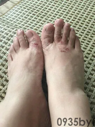 网传“70岁白叟就诊新规”不实（2026·03·31）