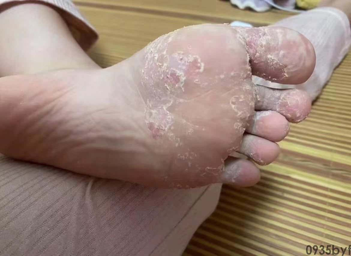 北京校园茅厕的“体检陈述”