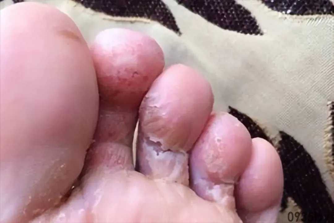 钢铁之躯2最新版本16(图1) 钢铁之躯2最新版本16