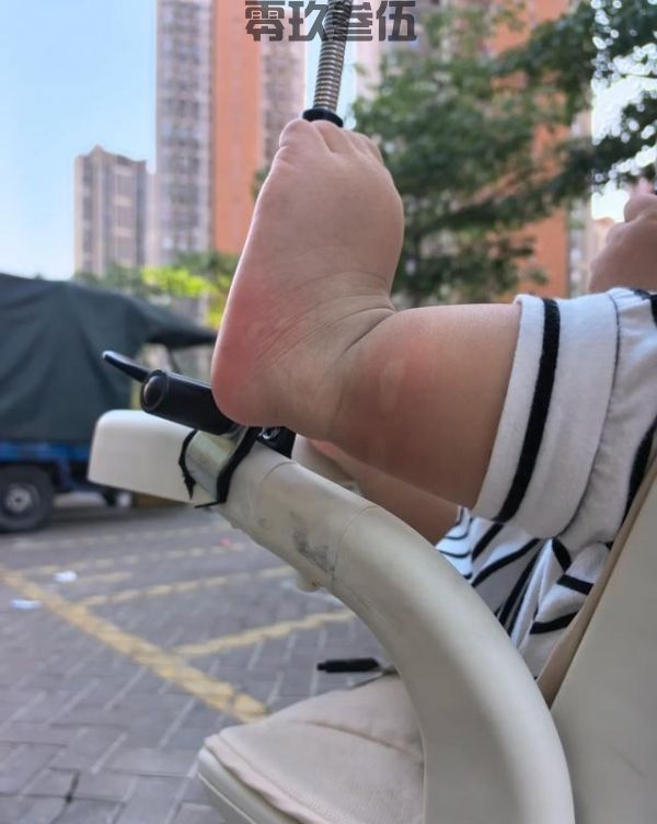 2块钱的硫磺皂不是大家都合适！哪些人不克不及用？(图4)