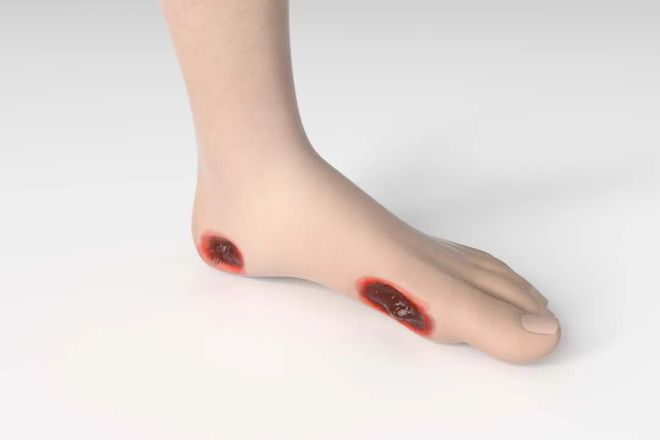 病从脚底生！身材有疾脚上的8个病症都是给你的警觉旌旗灯号！(图2)