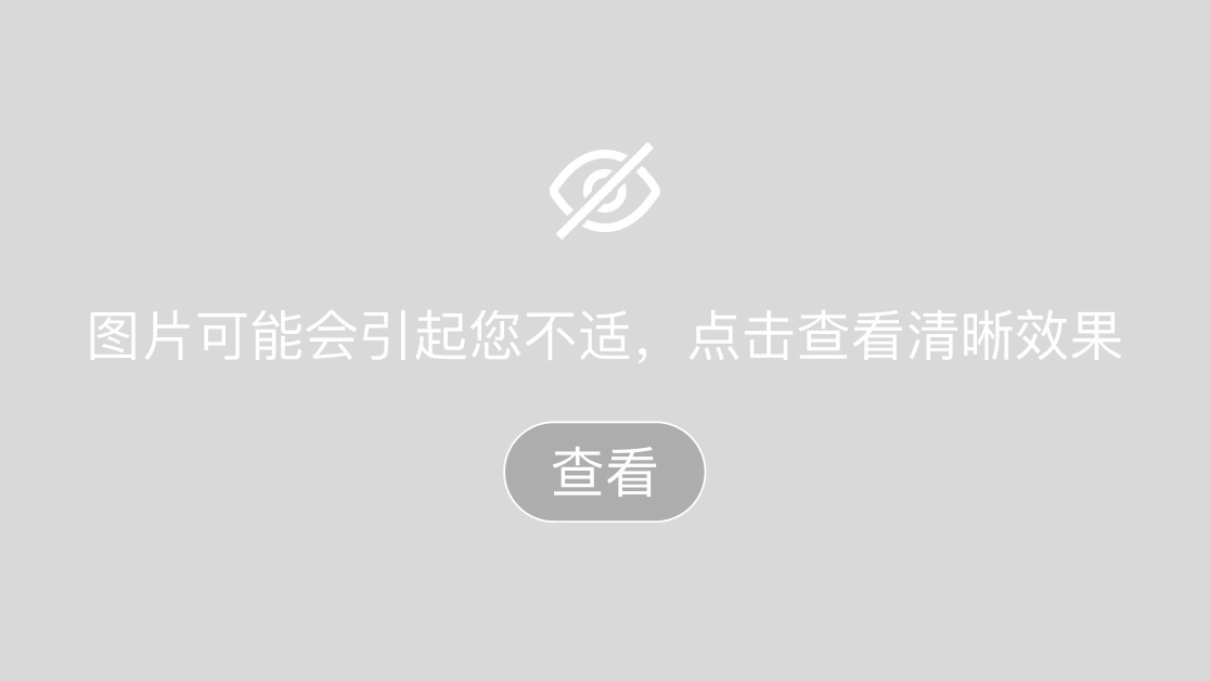 不同类型脚气的鉴别诊断