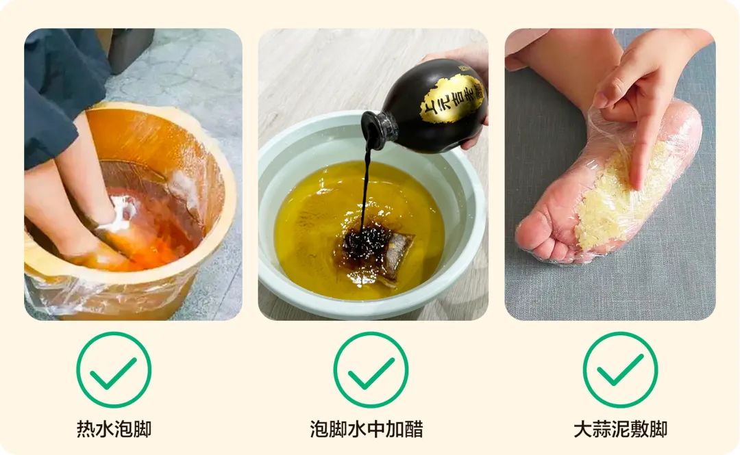 雨季足部防潮防脱皮技巧(图1) 雨季足部防潮防脱皮技巧