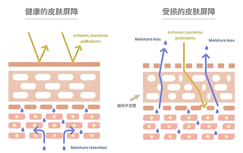 脚部糜烂皮肤屏障快速修复(图1) 脚部糜烂皮肤屏障快速修复