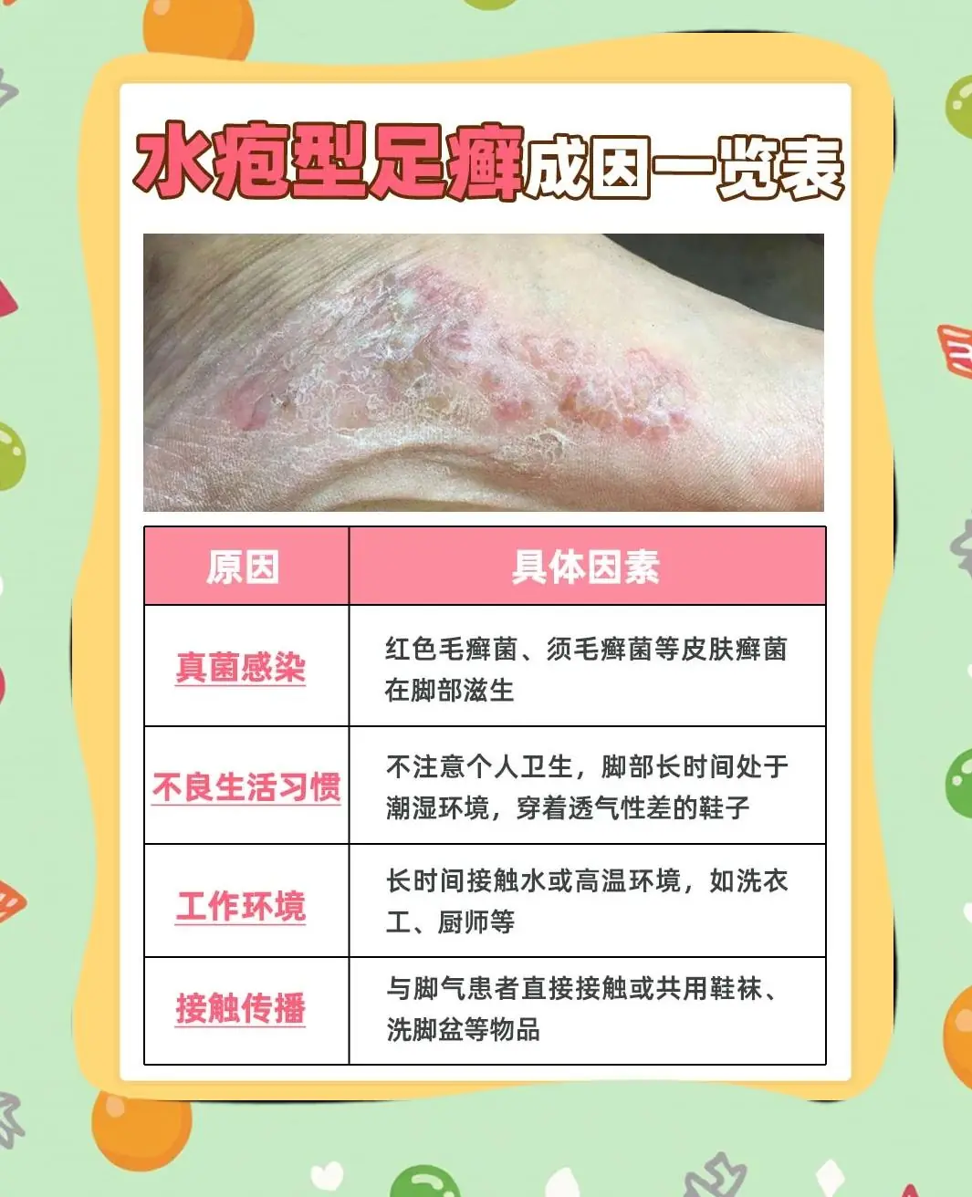 【健康问答】关于水疱型脚气的常见疑问