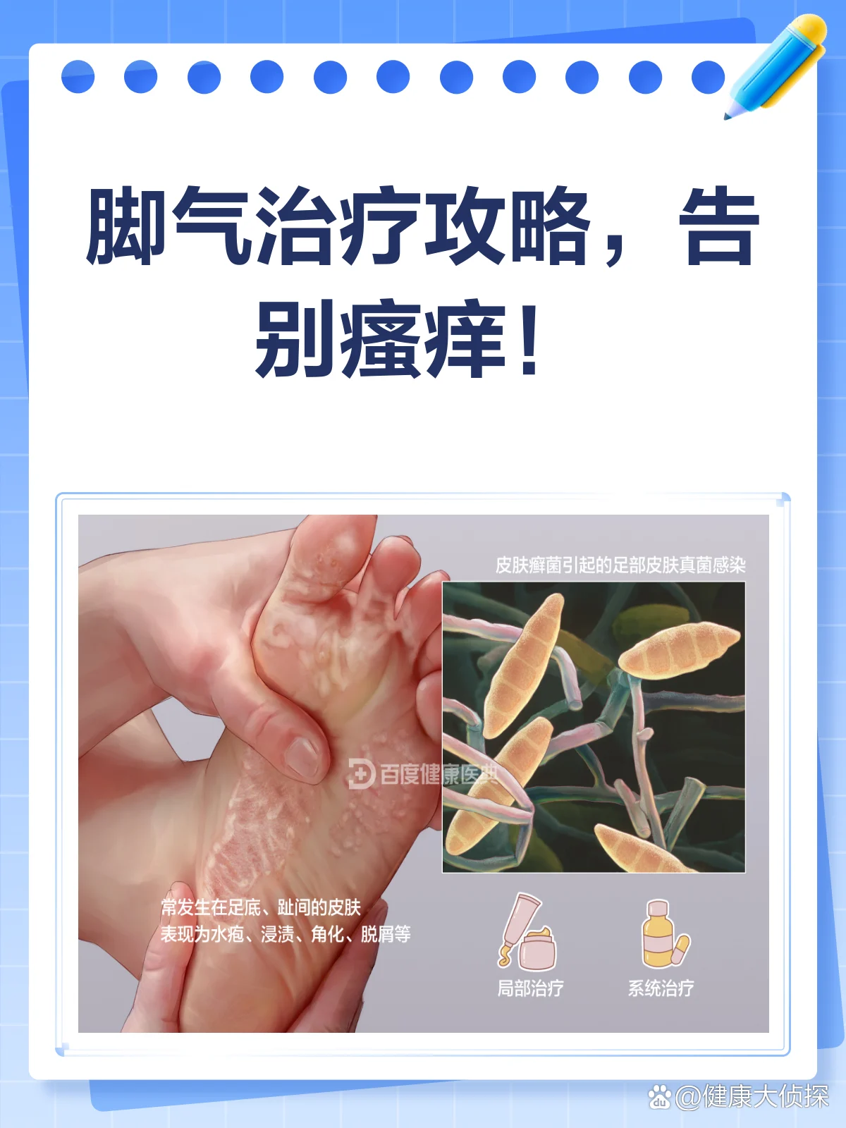【健康科普】脚气治疗患者必读指南