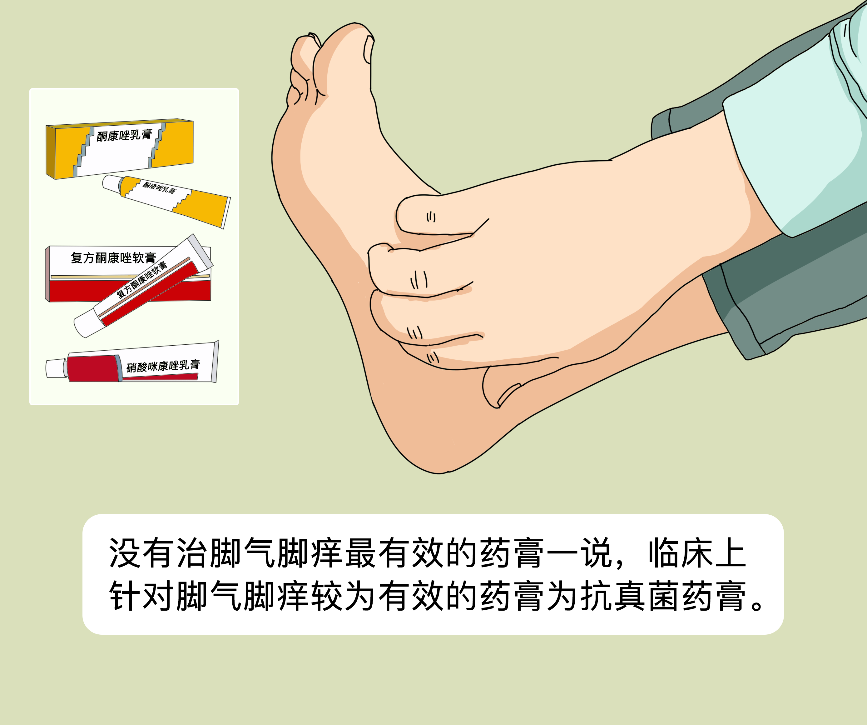 【专家解读】脚气用药的最新治疗方法