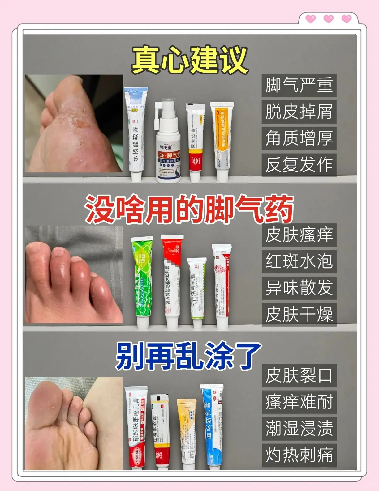 【健康科普】脚气用药患者必读指南