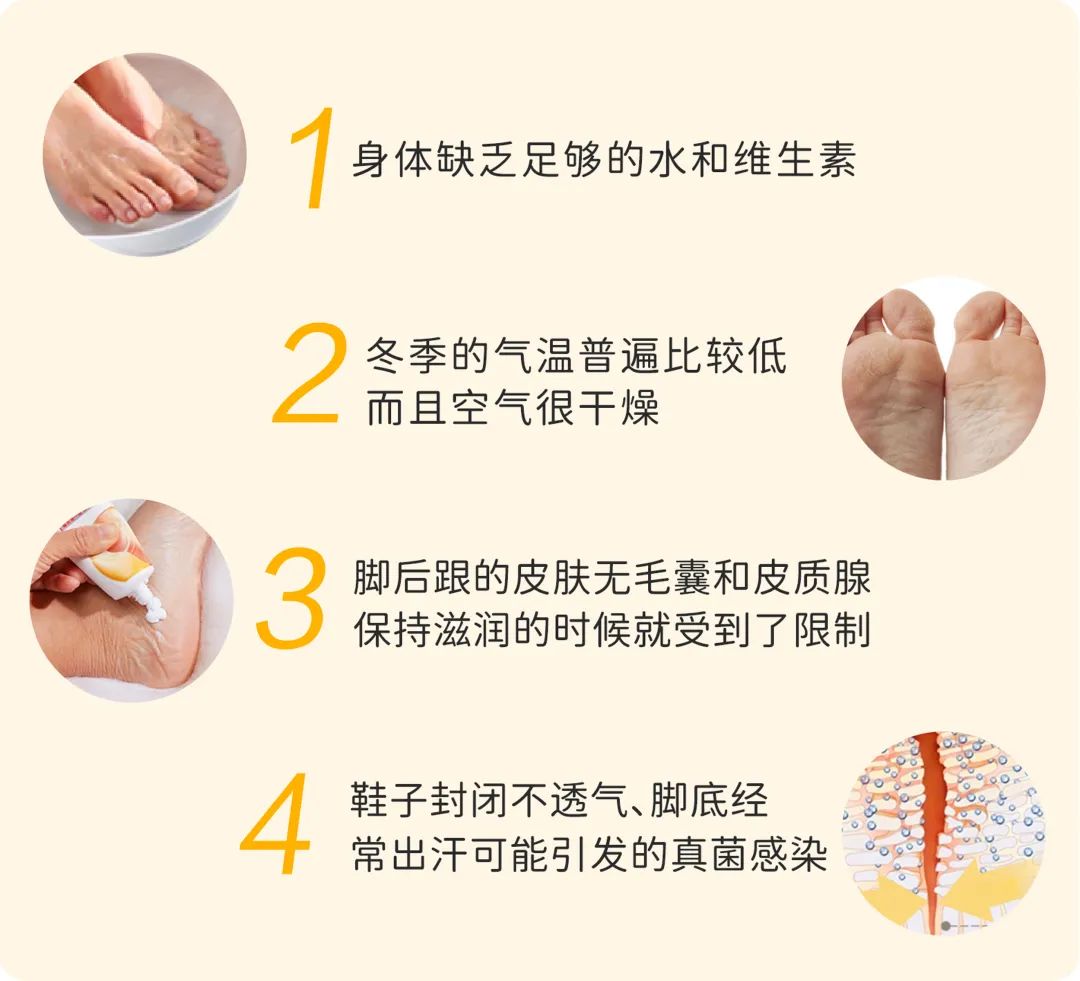 改善脚腕连接处脱皮