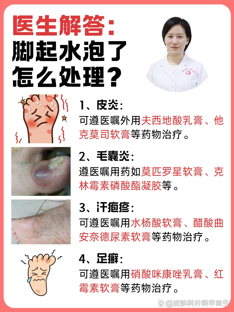 脚部水疱组织液吸收方法(图1) 脚部水疱组织液吸收方法