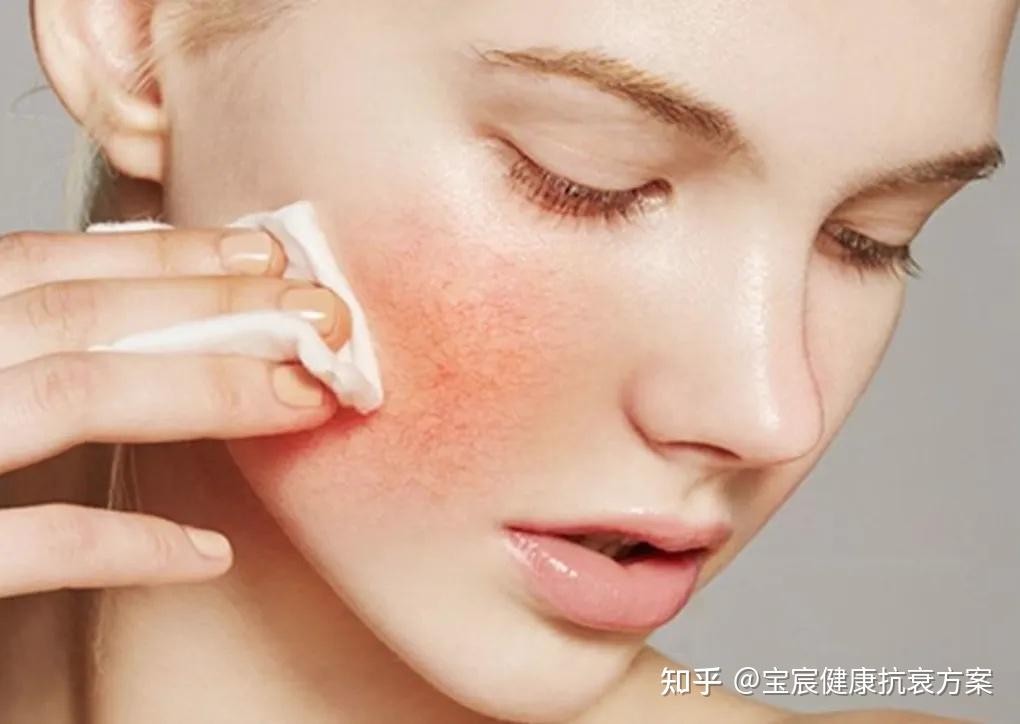 矿物成分舒缓脱皮不适(图1) 矿物成分舒缓脱皮不适