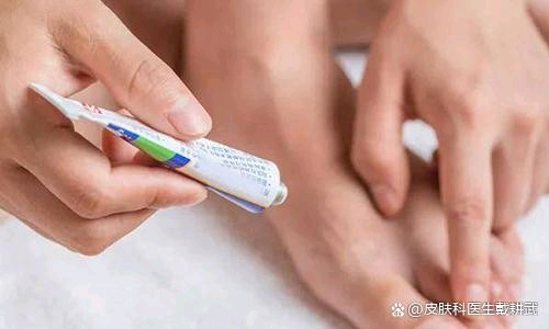 糜烂型脚气旅行途中护理技巧(图1) 糜烂型脚气旅行途中护理技巧