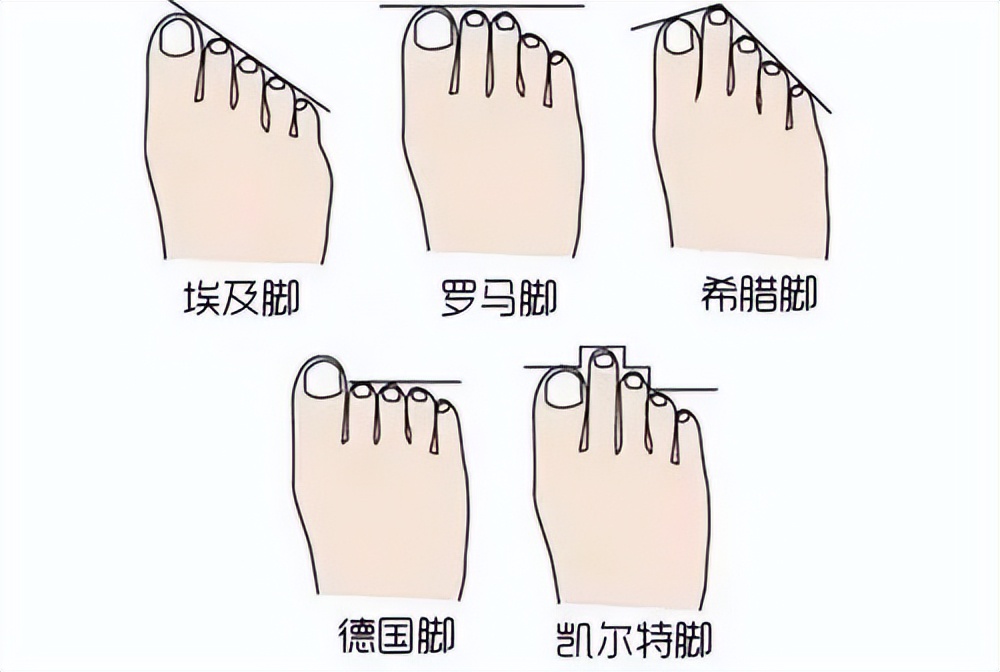 脚趾红斑治疗方法(图1) 脚趾红斑治疗方法