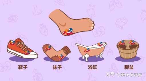 水疱型脚气阴雨天鞋袜防潮