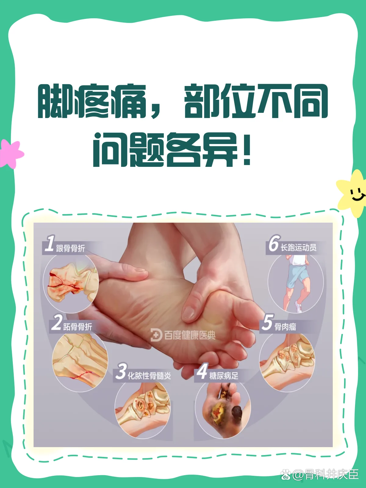 脚部糜烂刺痛后快速舒缓技巧(图1) 脚部糜烂刺痛后快速舒缓技巧