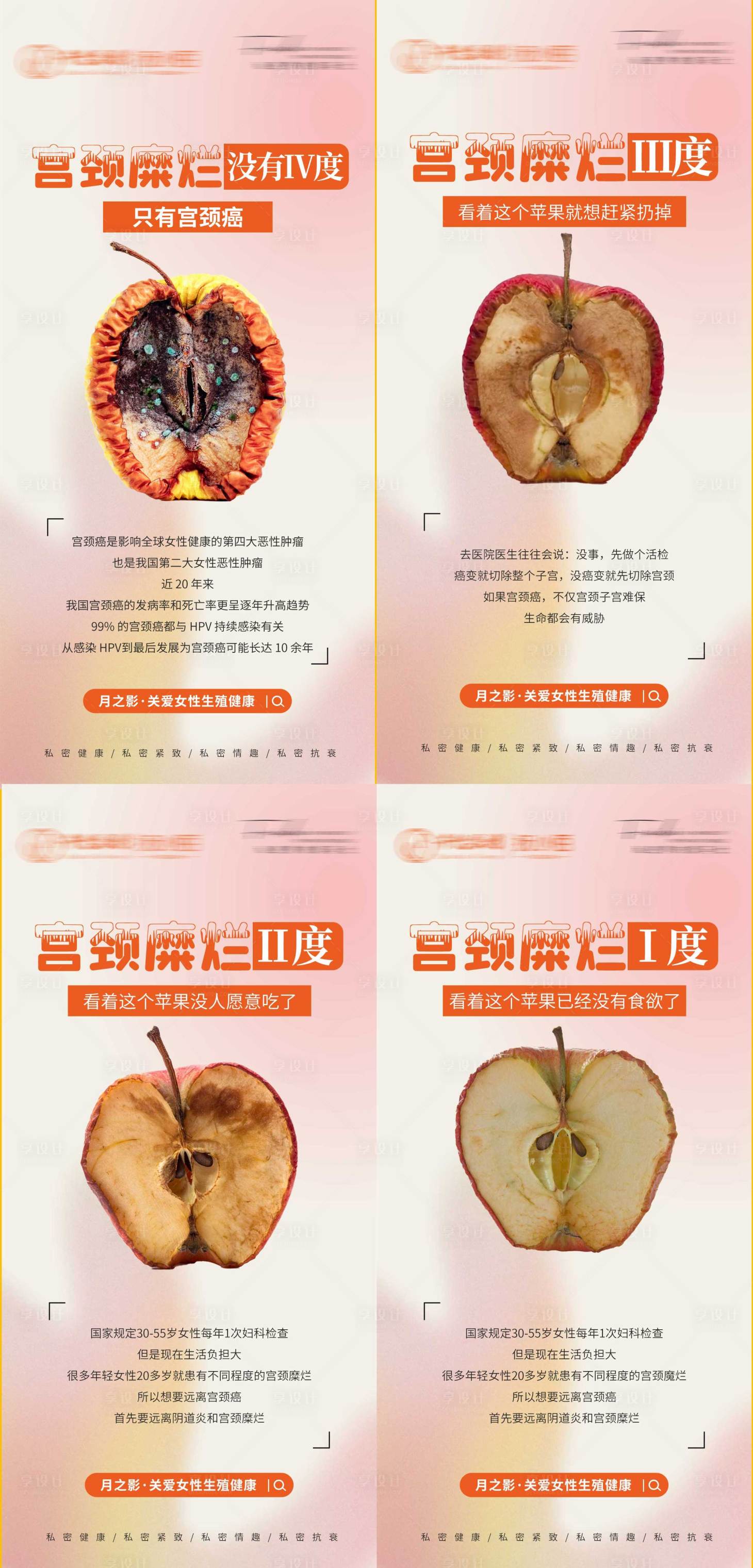 糜烂型脚气日常温和去屑保养方法